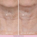 DEKLIDERM Neck Firming Cream – Anti Ageing Retinol Cream Visibly Scale back... - Image 8