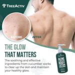 TreeActiv Pimples Eliminating Physique Lotion 8 fl oz | Clears Physique, Again, Bu... - Image 3