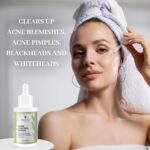 BEE and YOU Zits Remedy with Salicylic Acid, Bee Venom and 100% Nat... - Image 3