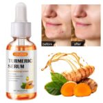 2 Pack Turmeric Serum for Darkish Spots, Turmeric Darkish Spot Corrector Ser... - Image 6