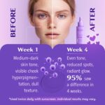 Pores and skin Pigmentation Corrector Serum, Niacinamide and Peptide MAX, 1.69 f... - Image 5