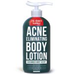 TreeActiv Pimples Eliminating Physique Lotion 8 fl oz | Clears Physique, Again, Bu... - Image 2