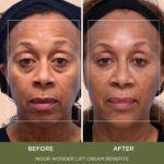 Noor Marvel Raise Cream for Girls, Pure Anti-Growing older Wrinkle teatment ... - Image 4