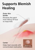 EasyDerm Magnificence Patch(42 Counts) - 100% Hydrocolloid Pimple Patch for ... - Image 4