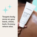 Proactiv Blemish Management Physique Cream - Exfoliating Salicylic Acid Clear... - Image 3
