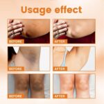 Pores and skin Whitening Cream for Physique, Darkish Spot Remover Corrector for Intimat... - Image 3