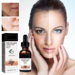 Melanin Correcting Facial Serum, Darkish Spot Corrector Each day Face Serum,... - Image 3
