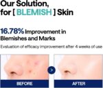 MEDIHEAL Toner Pads [Madecassoside] - Blemish Care Toner Pad with Cent... - Image 4