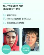 BRING GREEN ZINC TECA Serum with Niacinamide | Soothing Face Serum for... - Image 6