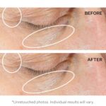 StriVectin Anti-Wrinkle Intensive Eye Cream Focus for Wrinkles P... - Image 4