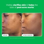 Paula's Alternative BOOST 10% Azelaic Acid Booster Cream Gel Face Serum wit... - Image 5