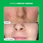 Paula's Alternative BOOST 10% Azelaic Acid Booster Cream Gel Face Serum wit... - Image 6