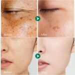 Darkish Spot Remover for Face and Physique - Darkish Spot Corrector for Face - S... - Image 4