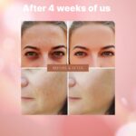 ELT 3-in-1 Triple Captuls Face Serum with Rose PDRN, Taurin, Niacinami... - Image 3