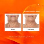 Naturium Vitamin C Advanced Face Serum, Anti-Growing older Facial Remedy wit... - Image 4