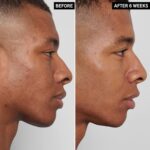 The INKEY Record Mandelic Acid Remedy, .5 fl oz - Image 5