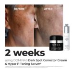 DOMINAS 10% Tranexamic Acid + 5% Mandelic Acid + 5% Niacinamide Vibrant... - Image 4