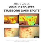 DOMINAS 10% Tranexamic Acid + 5% Mandelic Acid + 5% Niacinamide Vibrant... - Image 5