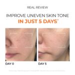 DOMINAS 10% Tranexamic Acid + 5% Mandelic Acid + 5% Niacinamide Vibrant... - Image 7