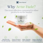 Further Pure Zits Fade Therapy - Most Power Face Cream for Se... - Image 3