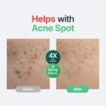 PURITO Centella Unscented Serum, 34,860 ppm Centella, Facial Serum for... - Image 3