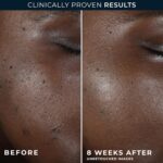 RoC Multi Correxion 5 in 1 Restoring, Anti Growing older Evening Cream for Face ... - Image 4