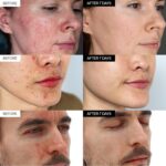 Intensive Cica Restore Cream, Korean Dexpanthenol cream, Restore Pores and skin B... - Image 6