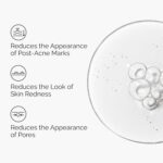 The Atypical Aloe 2% + NAG 2% Answer, Soothes Pores and skin and Targets Submit-... - Image 4