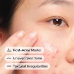 The Atypical Aloe 2% + NAG 2% Answer, Soothes Pores and skin and Targets Submit-... - Image 5