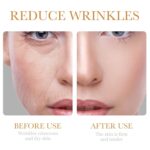 Collagen Pores and skin Care Set, 6Pcs Anti Growing older Face Care Units for Ladies, Agency... - Image 4