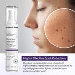 Darkish Spot Elimination Serum, Pure Components Darkish Spot Corrector, Soothes ... - Image 4