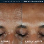 RoC Multi Correxion Revive + Glow 10% Lively Vitamin C Serum for Face,... - Image 5