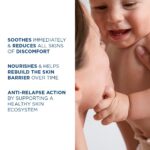 Bioderma Atoderm Intensive Balm, Hydrating Balm for Dry to Atopic Sens... - Image 8