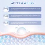 Underneath Eye Cream with Retinol – Reduces Darkish Circles, Puffy Eyes & Wrin... - Image 10