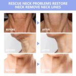 Neck Firming Cream - Anti-Ageing Neck Cream for tightening and Wrinkles... - Image 4